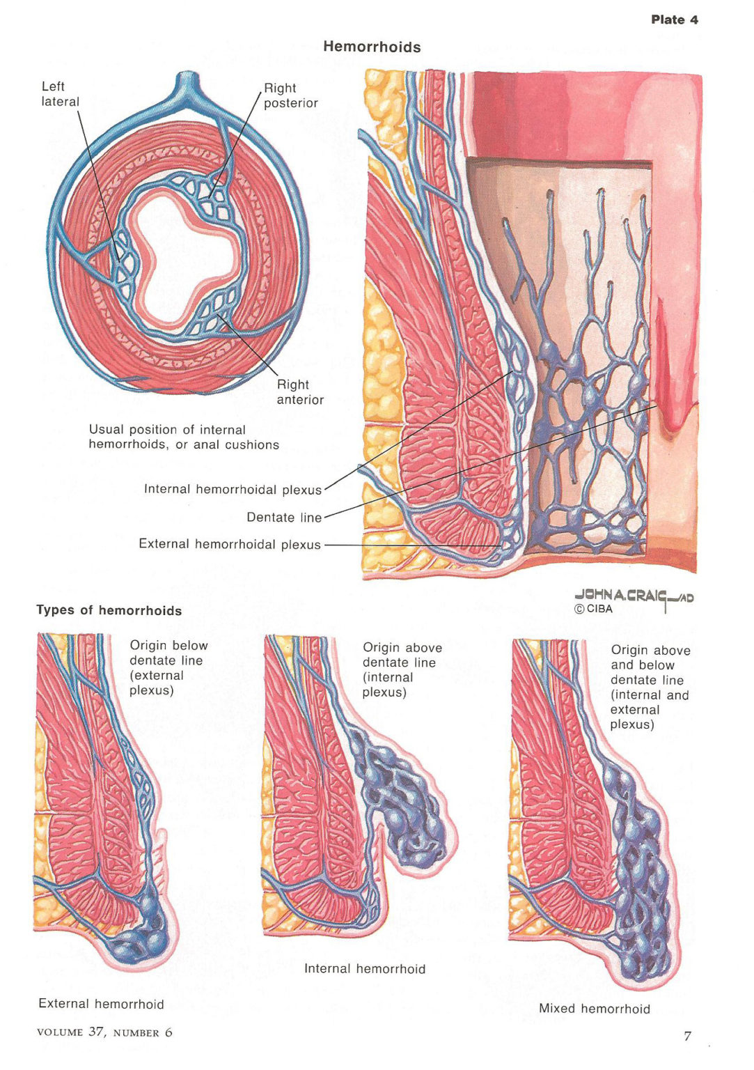 illustrations-hemorrhoid-treatment-center-of-florida